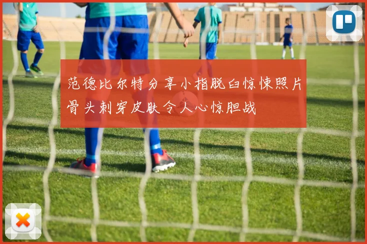 范德比尔特分享小指脱臼惊悚照片骨头刺穿皮肤令人心惊胆战